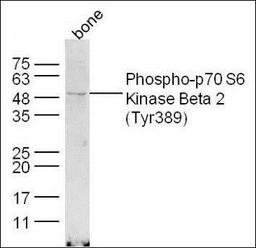 Western blot analysis of extracts from Bone tissue using Phospho-p70S6 Kinase Beta(Tyr389) antibody.