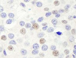 Detection of human GTF3C1/TFIIIC220 by immunohistochemistry.