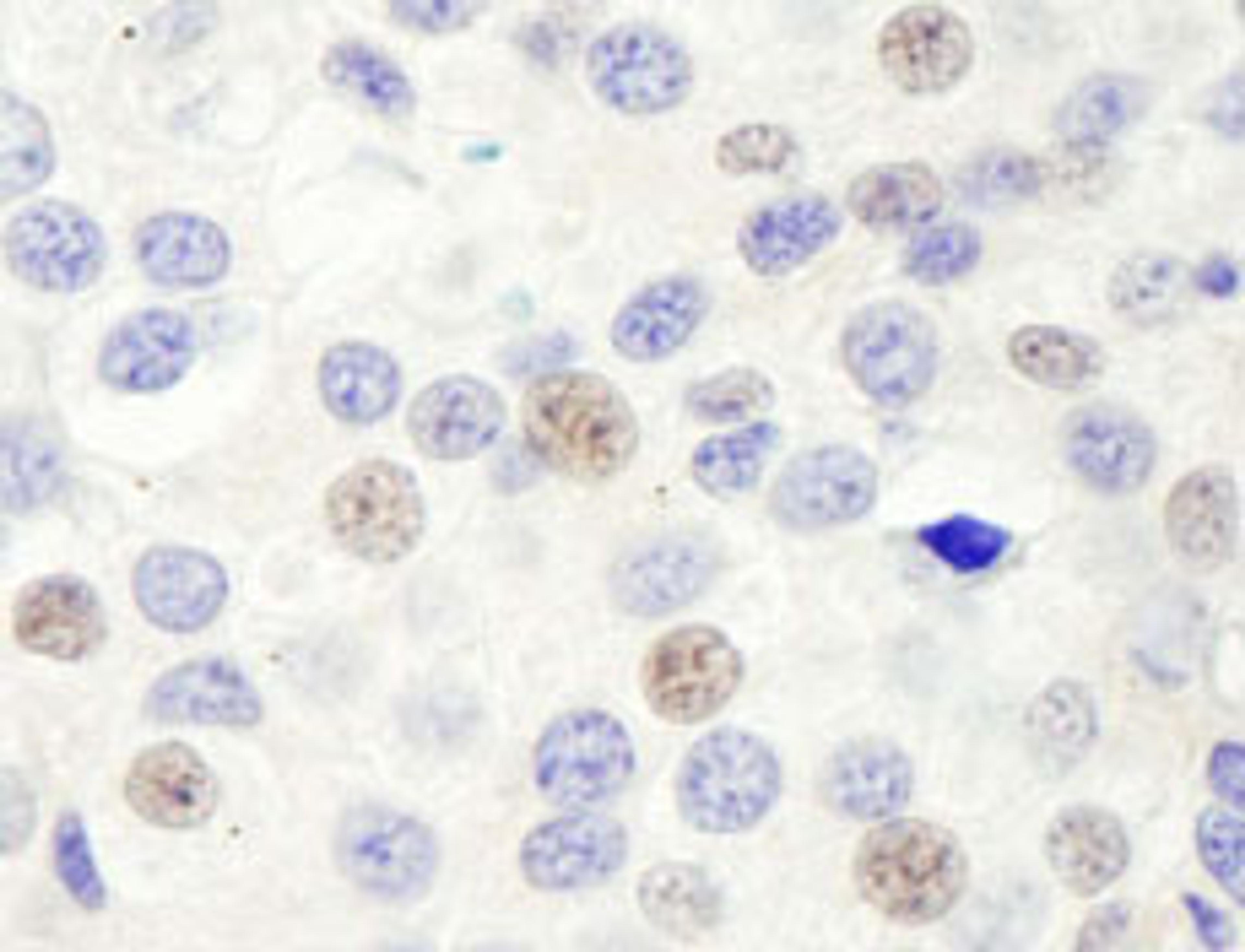 Detection of human GTF3C1/TFIIIC220 by immunohistochemistry.