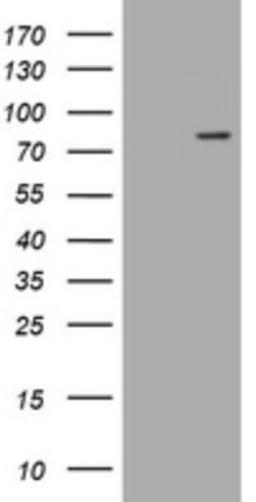 Western Blot: LRCH4 Antibody (1F8) [NBP2-45795] - Analysis of HEK293T cells were transfected with the pCMV6-ENTRY control (Left lane) or pCMV6-ENTRY LRCH4.