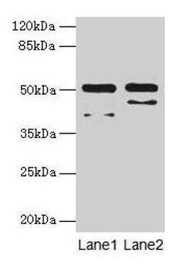 Western blot. All lanes: CRHR1 antibody at 16µg/ml. Lane 1: Hela whole cell lysate. Lane 2: HL60 whole cell lysate. Secondary. Goat polyclonal to rabbit IgG at 1/10000 dilution. Predicted band size: 51, 48, 44, 47, 29 kDa. Observed band size: 51 kDa