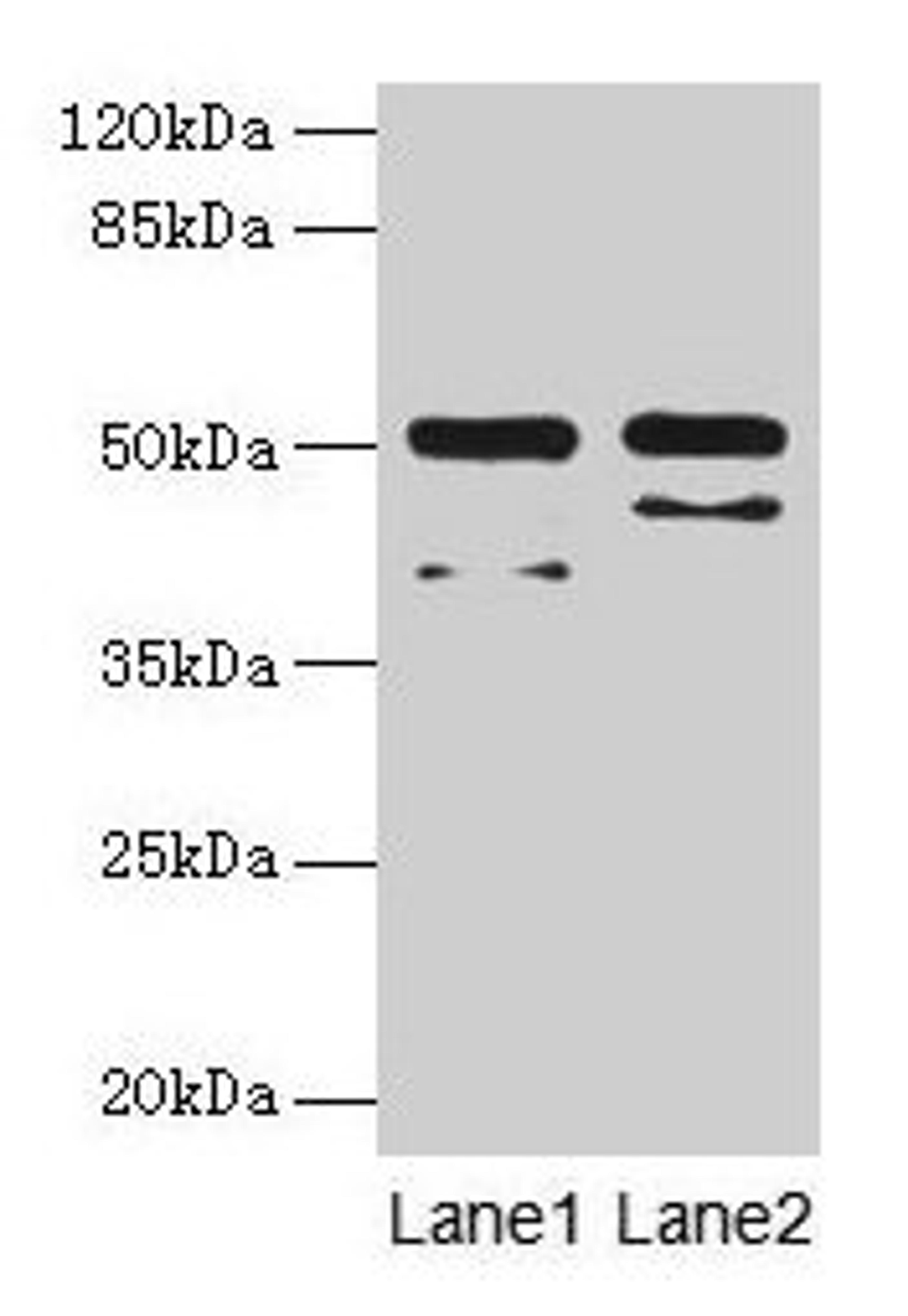 Western blot. All lanes: CRHR1 antibody at 16µg/ml. Lane 1: Hela whole cell lysate. Lane 2: HL60 whole cell lysate. Secondary. Goat polyclonal to rabbit IgG at 1/10000 dilution. Predicted band size: 51, 48, 44, 47, 29 kDa. Observed band size: 51 kDa