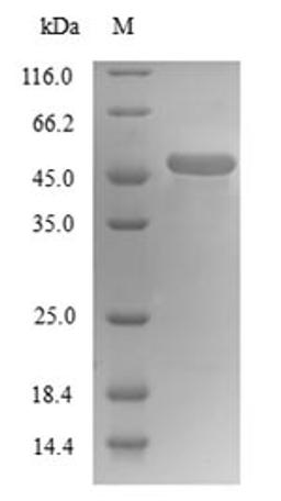 (Tris-Glycine gel) Discontinuous SDS-PAGE (reduced) with 5% enrichment gel and 15% separation gel.