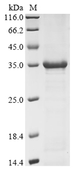 (Tris-Glycine gel) Discontinuous SDS-PAGE (reduced) with 5% enrichment gel and 15% separation gel.