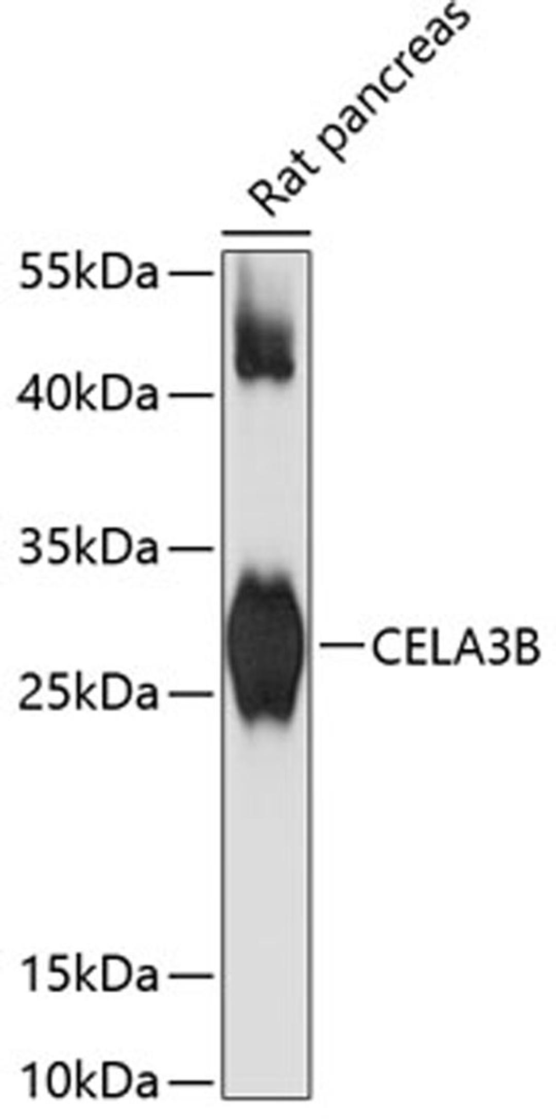 Western blot - CELA3B antibody (A13714)