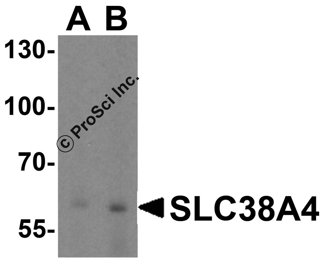 Western blot analysis of SLC38A4 in mouse kidney tissue lysate with SLC38A4 antibody at (A) 1 and (B) 2 μg/ml.