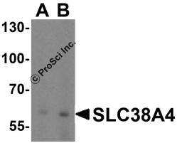 Western blot analysis of SLC38A4 in mouse kidney tissue lysate with SLC38A4 antibody at (A) 1 and (B) 2 μg/ml.