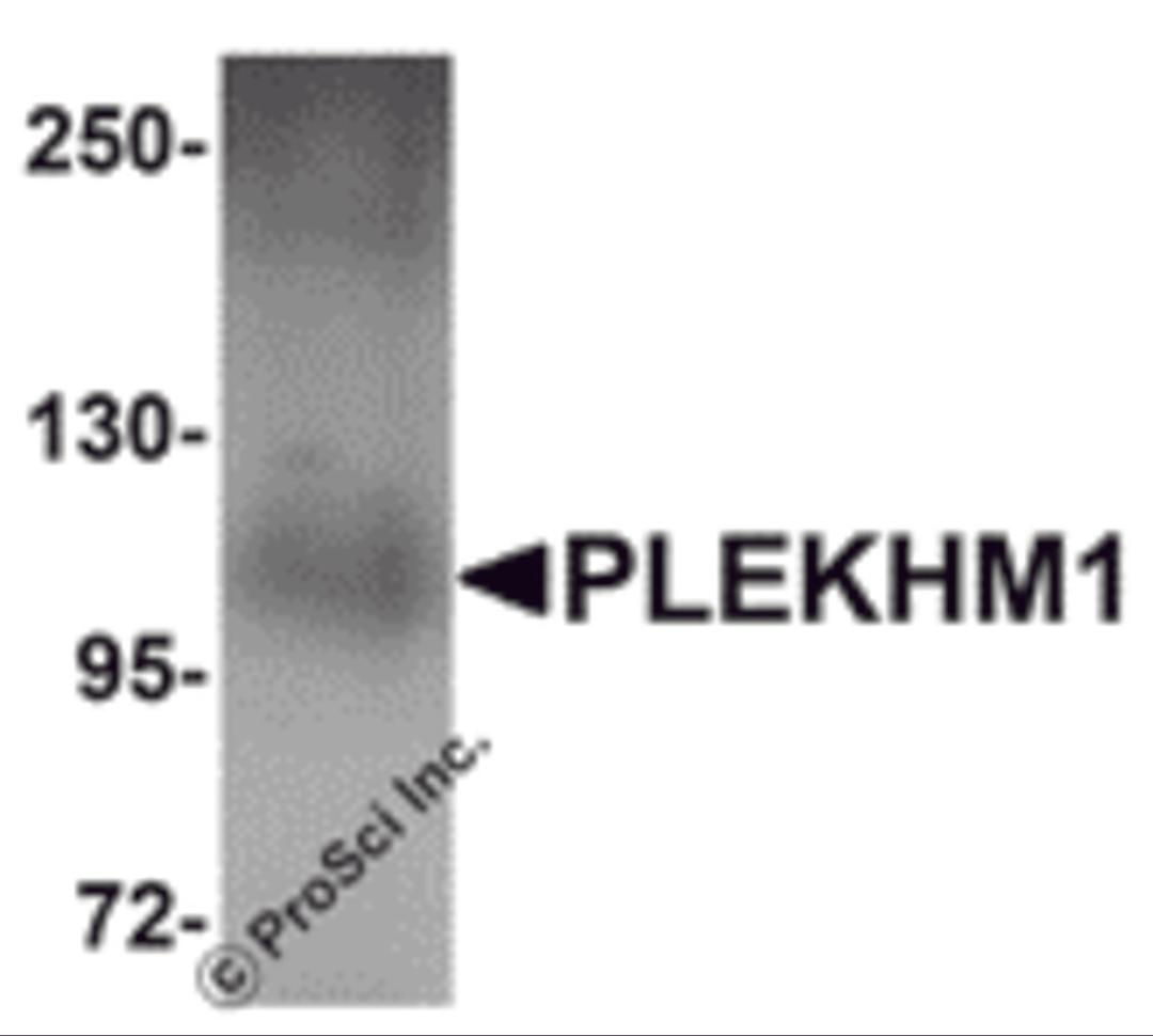 Western blot analysis of PLEKHM1 in human lung tissue lysate with PLEKHM1 antibody at 1 &#956;g/mL.