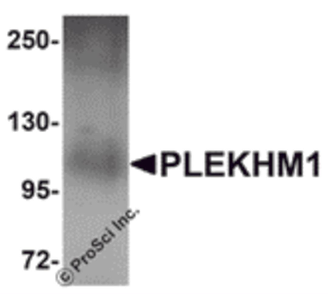 Western blot analysis of PLEKHM1 in human lung tissue lysate with PLEKHM1 antibody at 1 μg/mL.