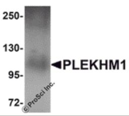 Western blot analysis of PLEKHM1 in human lung tissue lysate with PLEKHM1 antibody at 1 μg/mL.