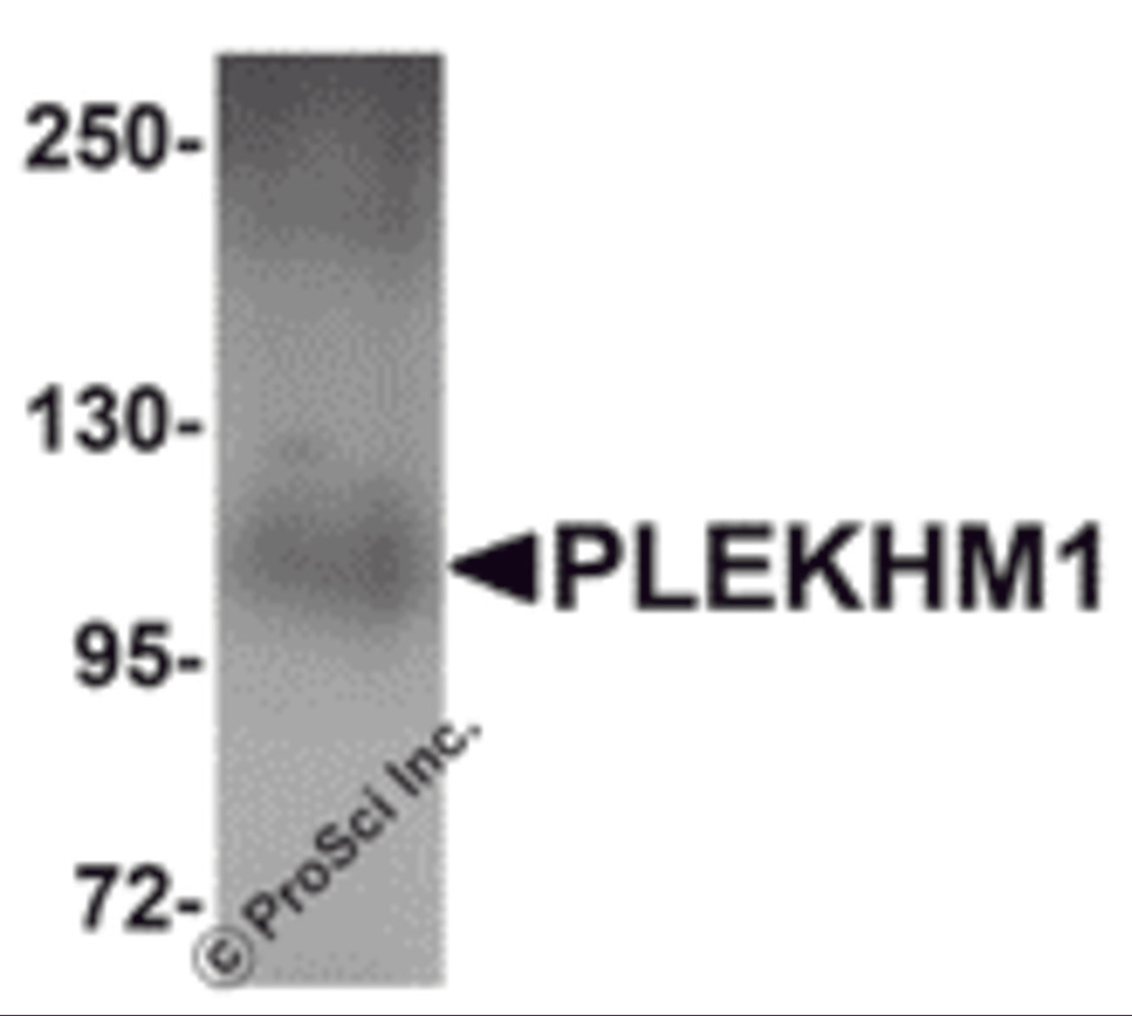 Western blot analysis of PLEKHM1 in human lung tissue lysate with PLEKHM1 antibody at 1 μg/mL.