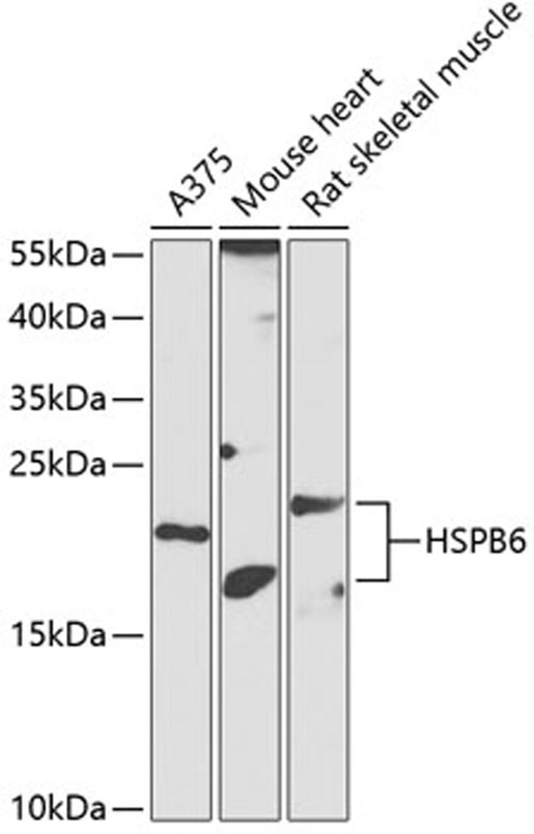 Western blot - HSPB6 antibody (A14158)