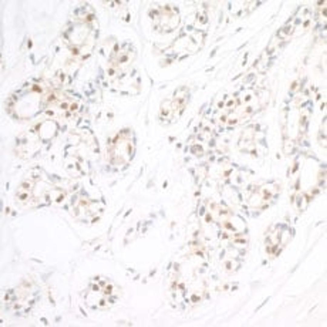 Detection of human RAP80 by immunohistochemistry.