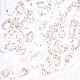 Detection of human RAP80 by immunohistochemistry.