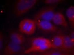 Immunofluorescence staining of methanol-fixed HeLa cells using Tyrosine Hydroxylase (Phospho-Ser40).