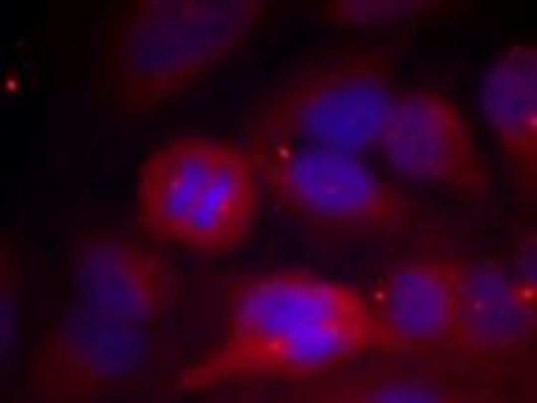 Immunofluorescence staining of methanol-fixed HeLa cells using Tyrosine Hydroxylase (Phospho-Ser40).
