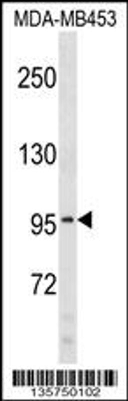 Western blot analysis in MDA-MB453 cell line lysates (35ug/lane).