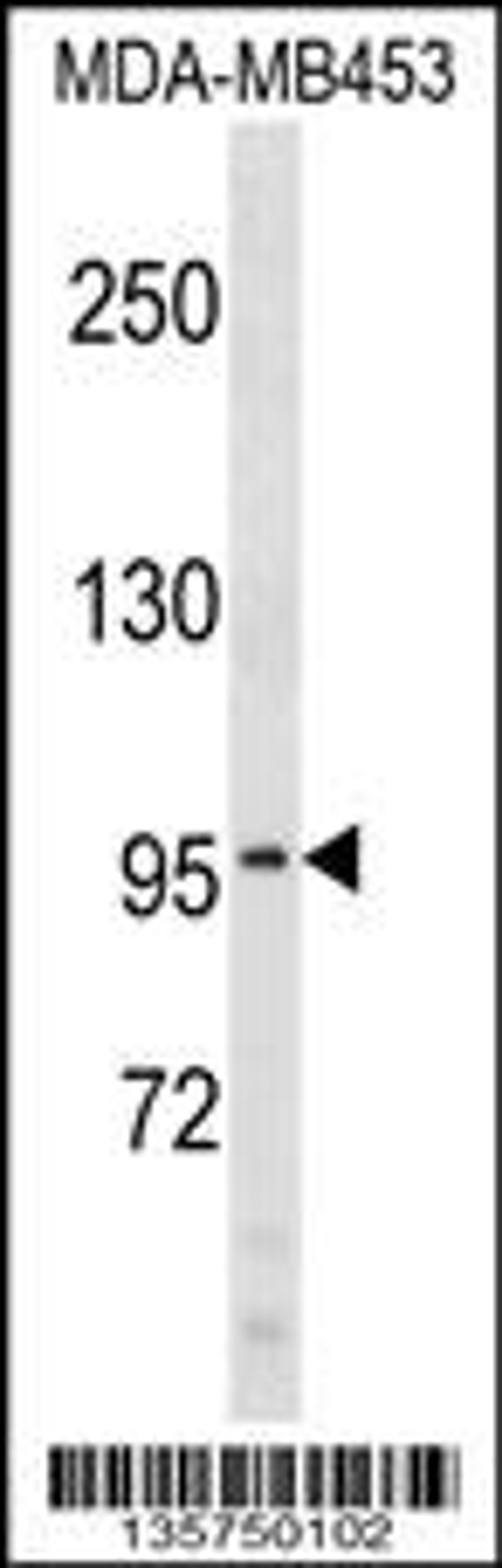 Western blot analysis in MDA-MB453 cell line lysates (35ug/lane).