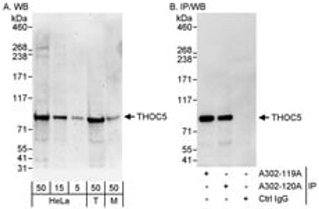 Detection of human and mouse THOC5 by western blot (h&m) and immunoprecipitation (h).