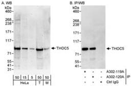 Detection of human and mouse THOC5 by western blot (h&m) and immunoprecipitation (h).