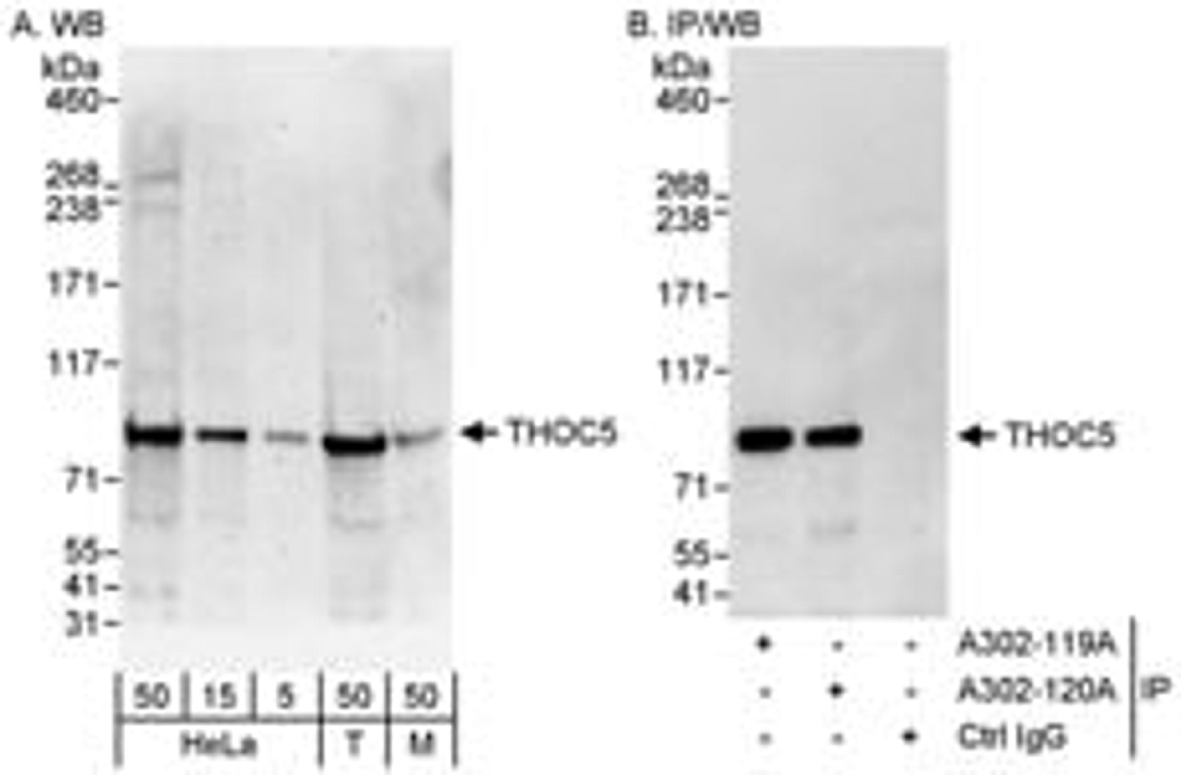 Detection of human and mouse THOC5 by western blot (h&m) and immunoprecipitation (h).