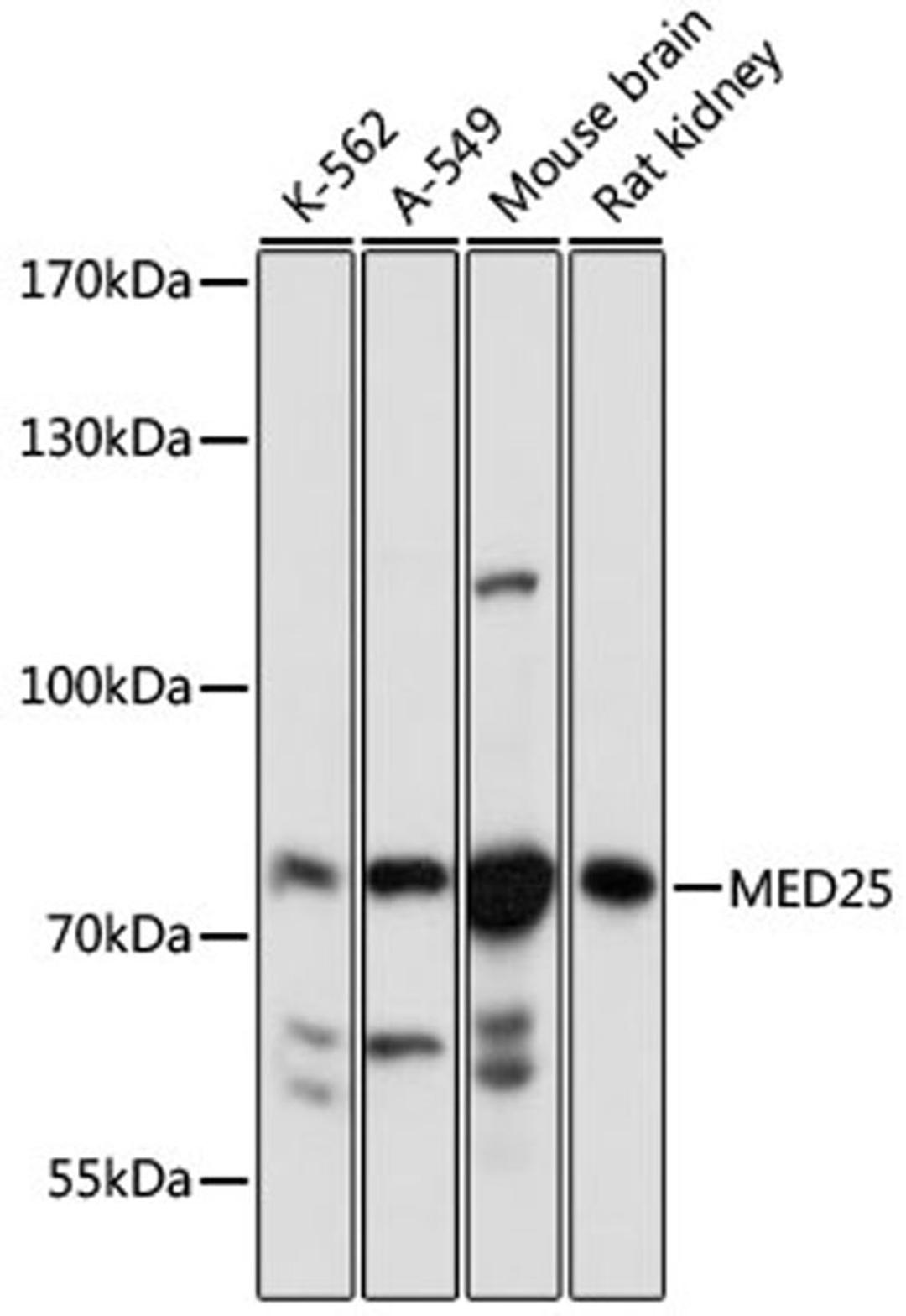 Western blot - MED25 antibody (A16150)