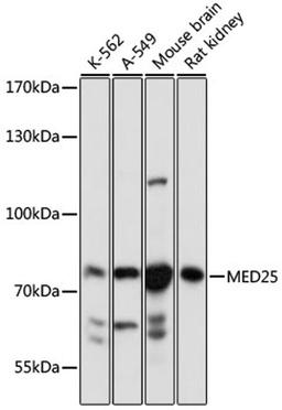 Western blot - MED25 antibody (A16150)