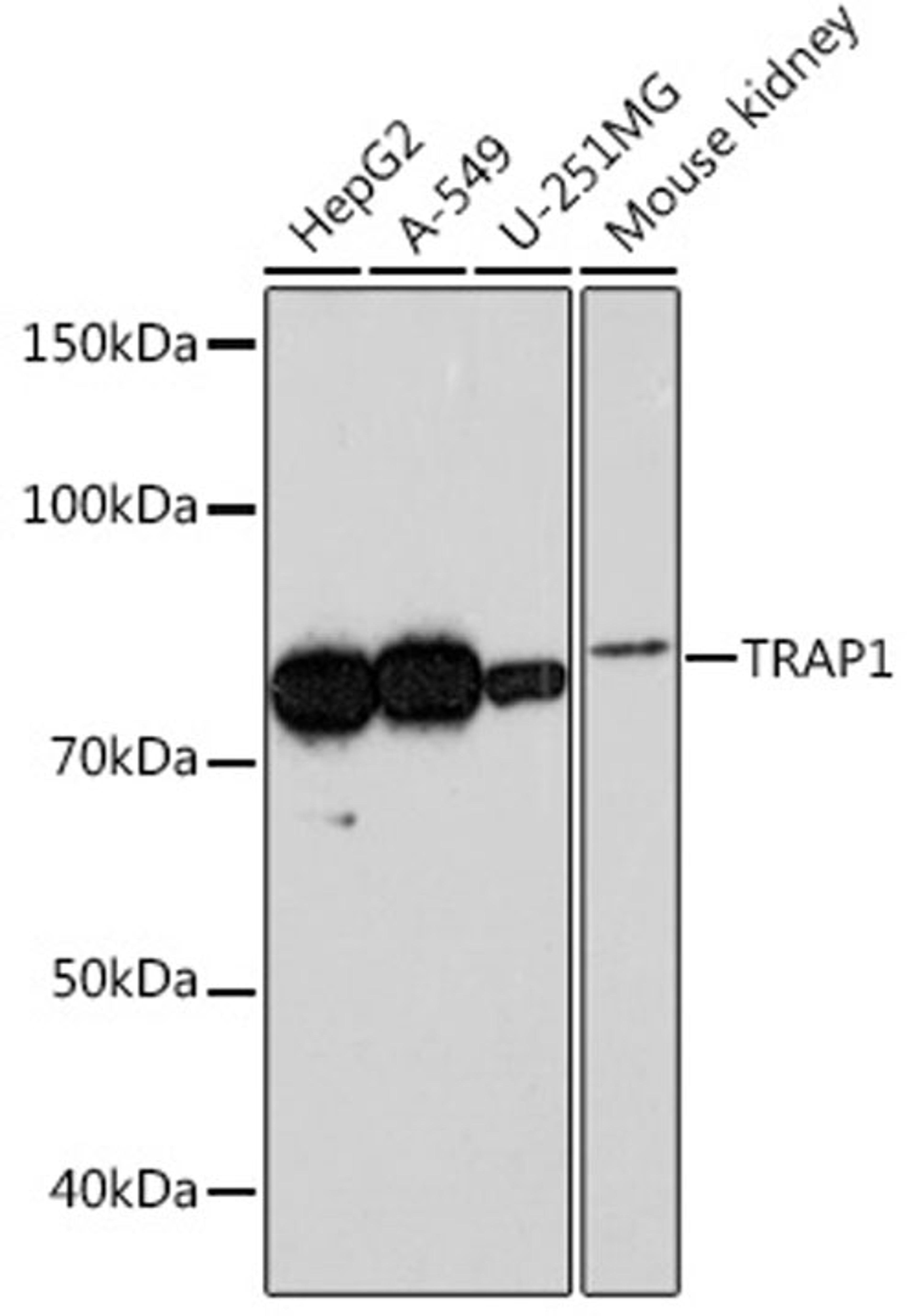 Western blot - TRAP1 Rabbit mAb (A3971)