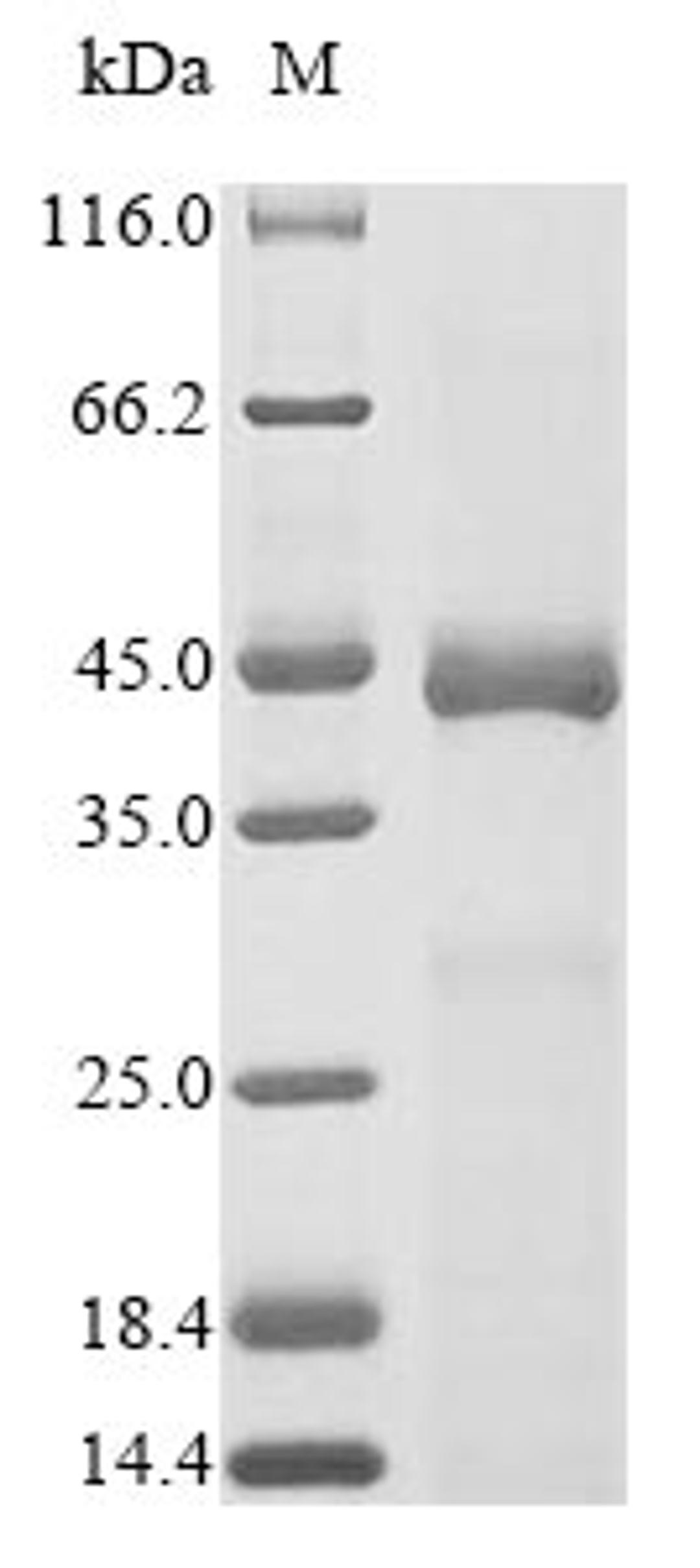 (Tris-Glycine gel) Discontinuous SDS-PAGE (reduced) with 5% enrichment gel and 15% separation gel.