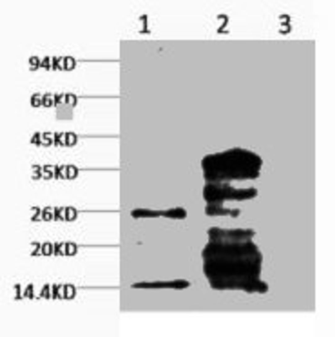 Western blot analysis of Hela, diluted at  1) 1:1000  2) 1:3000