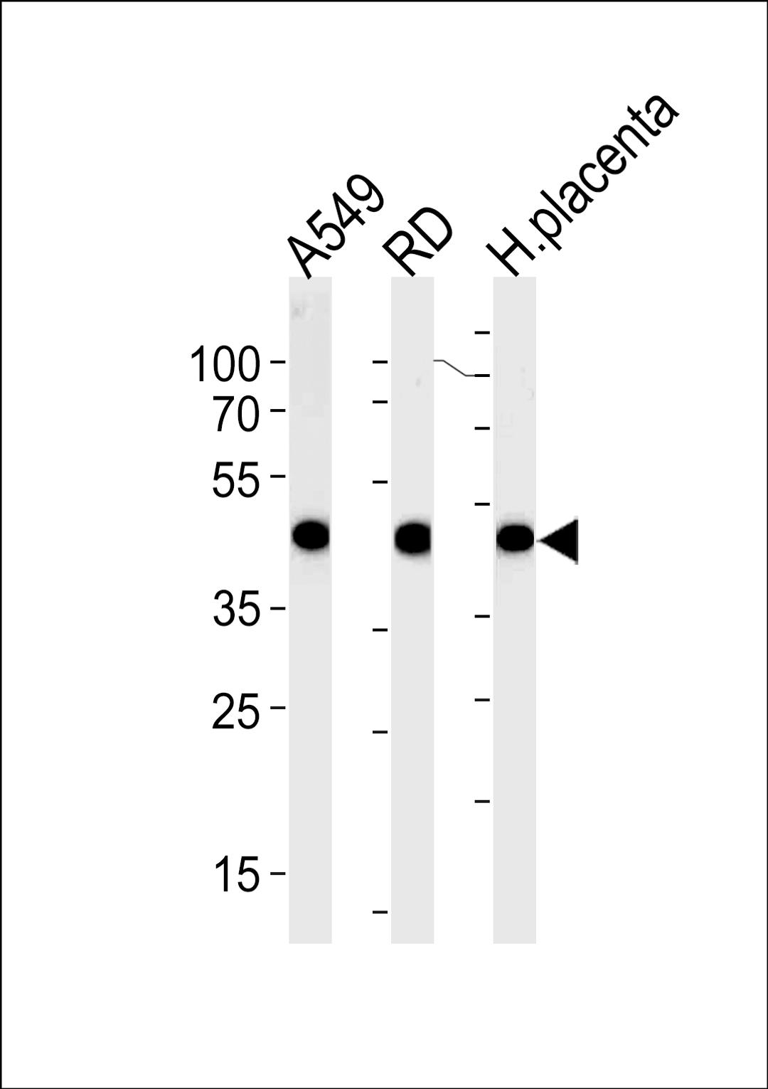 Western blot analysis in A549,RD cell line and human placenta lysates (35ug/lane).This demonstrates the ACTA1/alpha -actin antibody detected the ACTA1/alpha -actin protein (arrow).