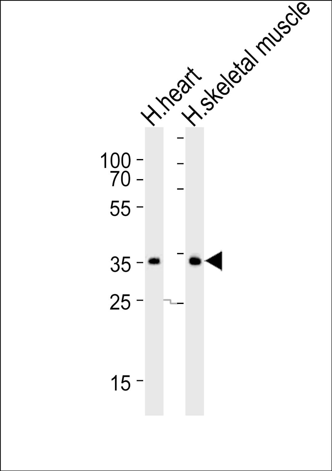 Western blot analysis of lysates from human heart and human skeletal muscle tissue lysate (from left to right), using DIO2 Antibody at 1:1000 at each lane.