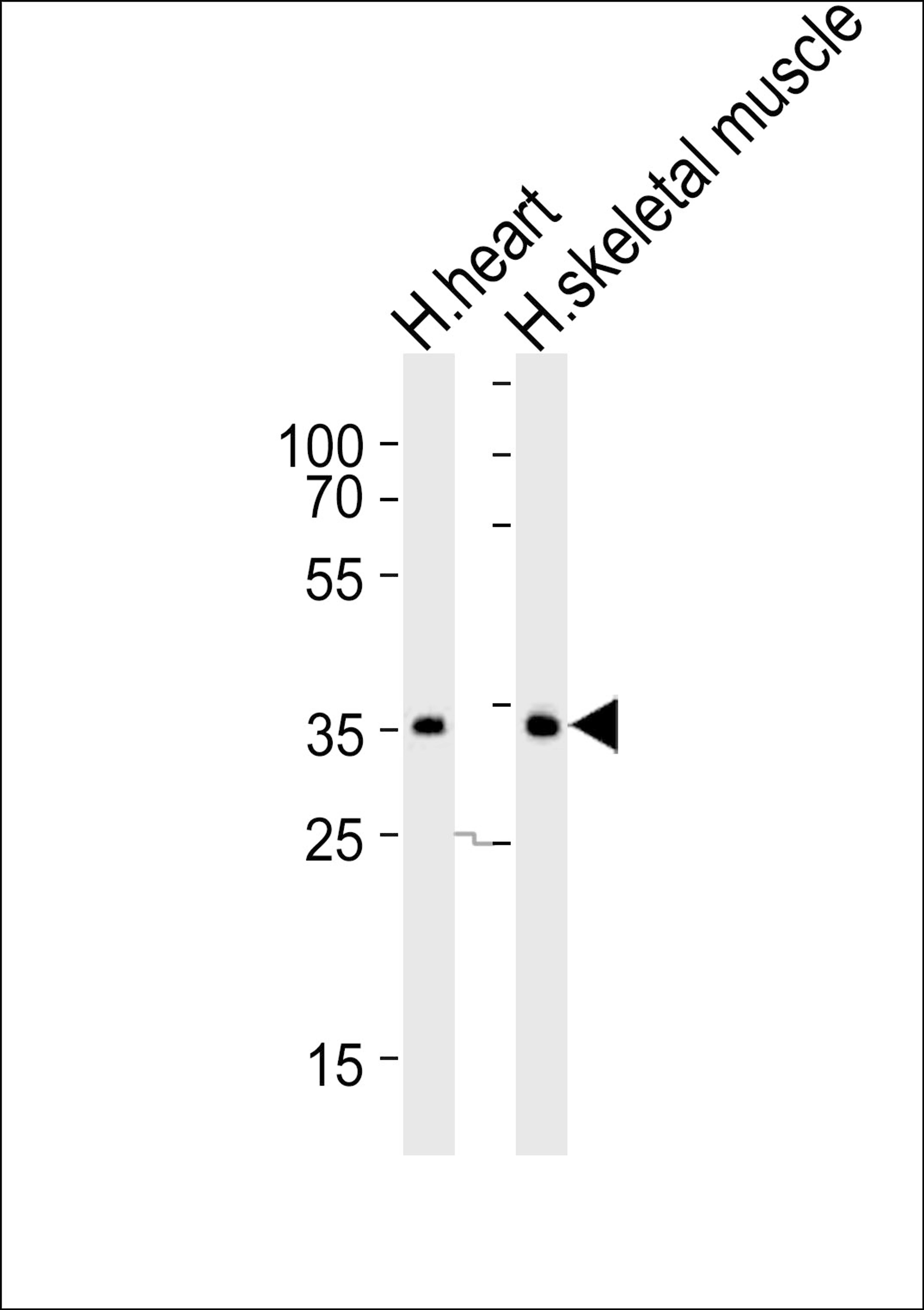 Western blot analysis of lysates from human heart and human skeletal muscle tissue lysate (from left to right), using DIO2 Antibody at 1:1000 at each lane.