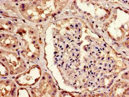 Immunohistochemistry of paraffin-embedded human kidney tissue using CSB-PA883444LA01HU at dilution of 1:100