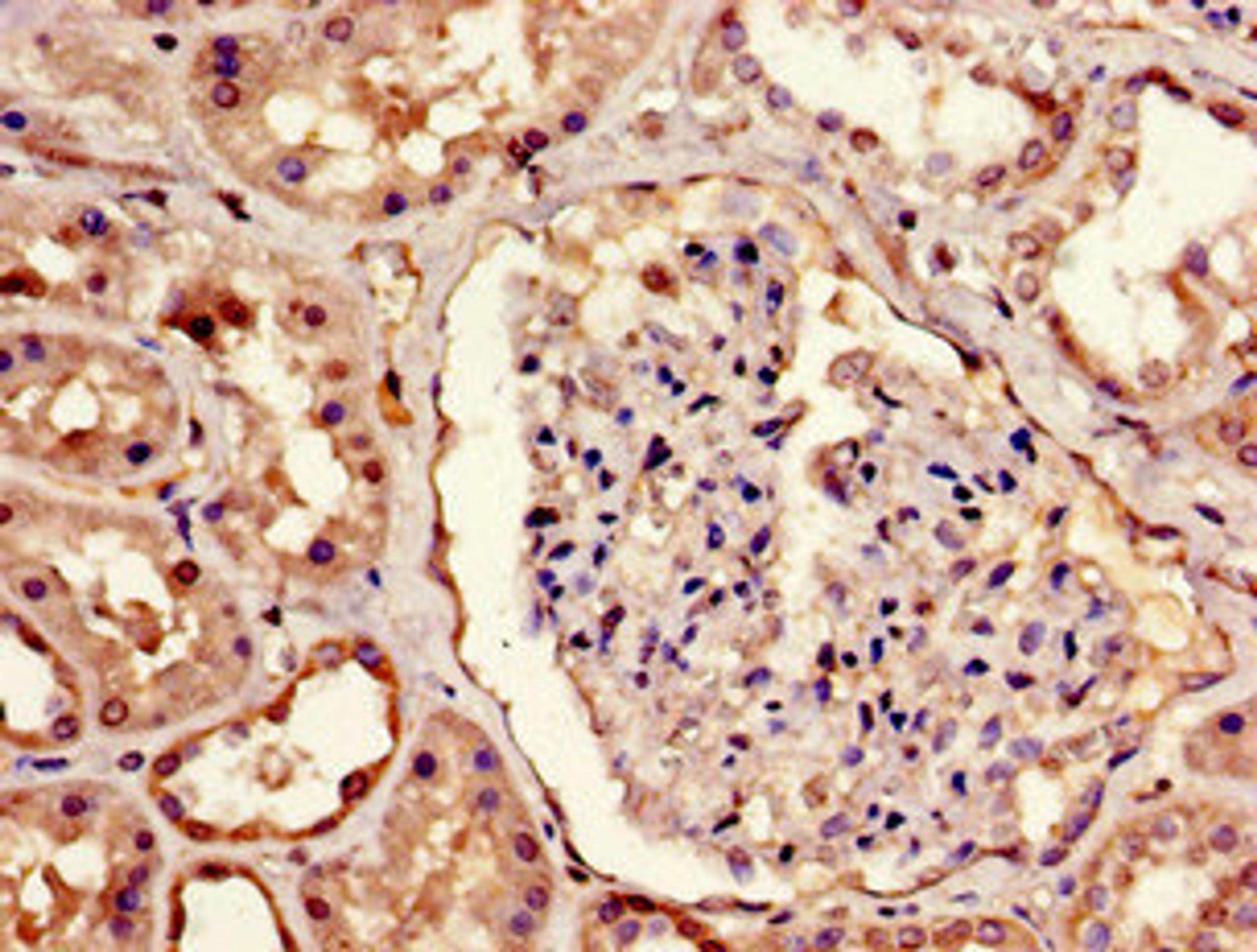 Immunohistochemistry of paraffin-embedded human kidney tissue using CSB-PA883444LA01HU at dilution of 1:100