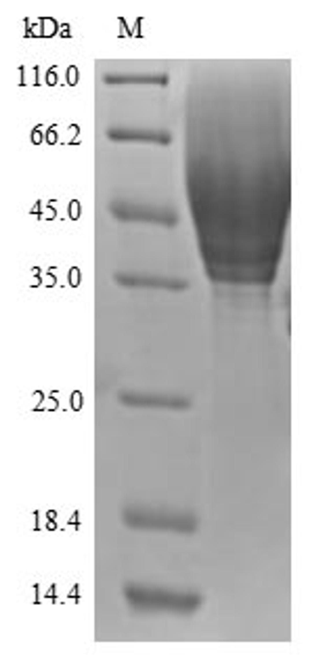 (Tris-Glycine gel) Discontinuous SDS-PAGE (reduced) with 5% enrichment gel and 15% separation gel.