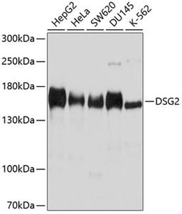 Western blot - DSG2 antibody (A9480)