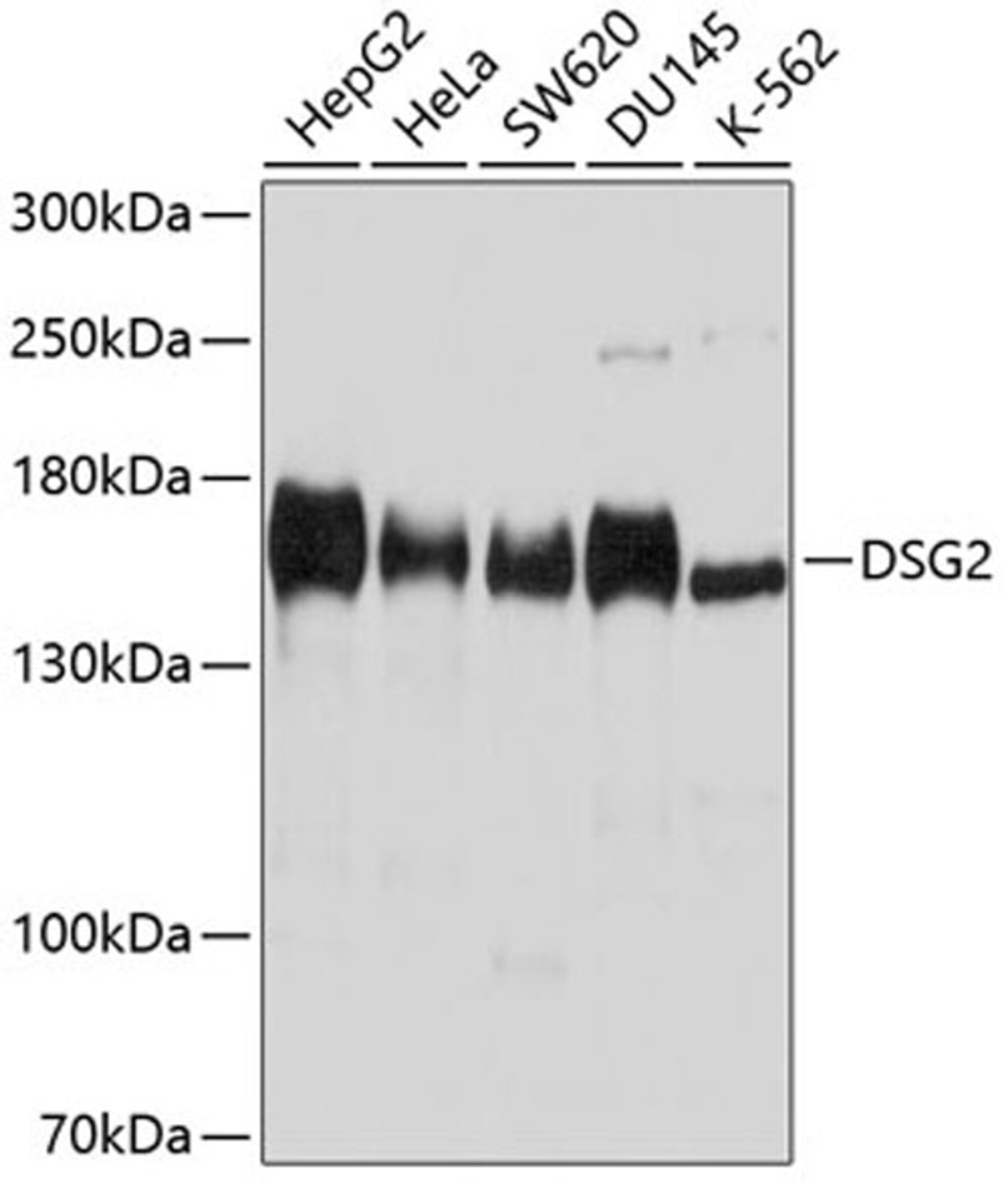 Western blot - DSG2 antibody (A9480)