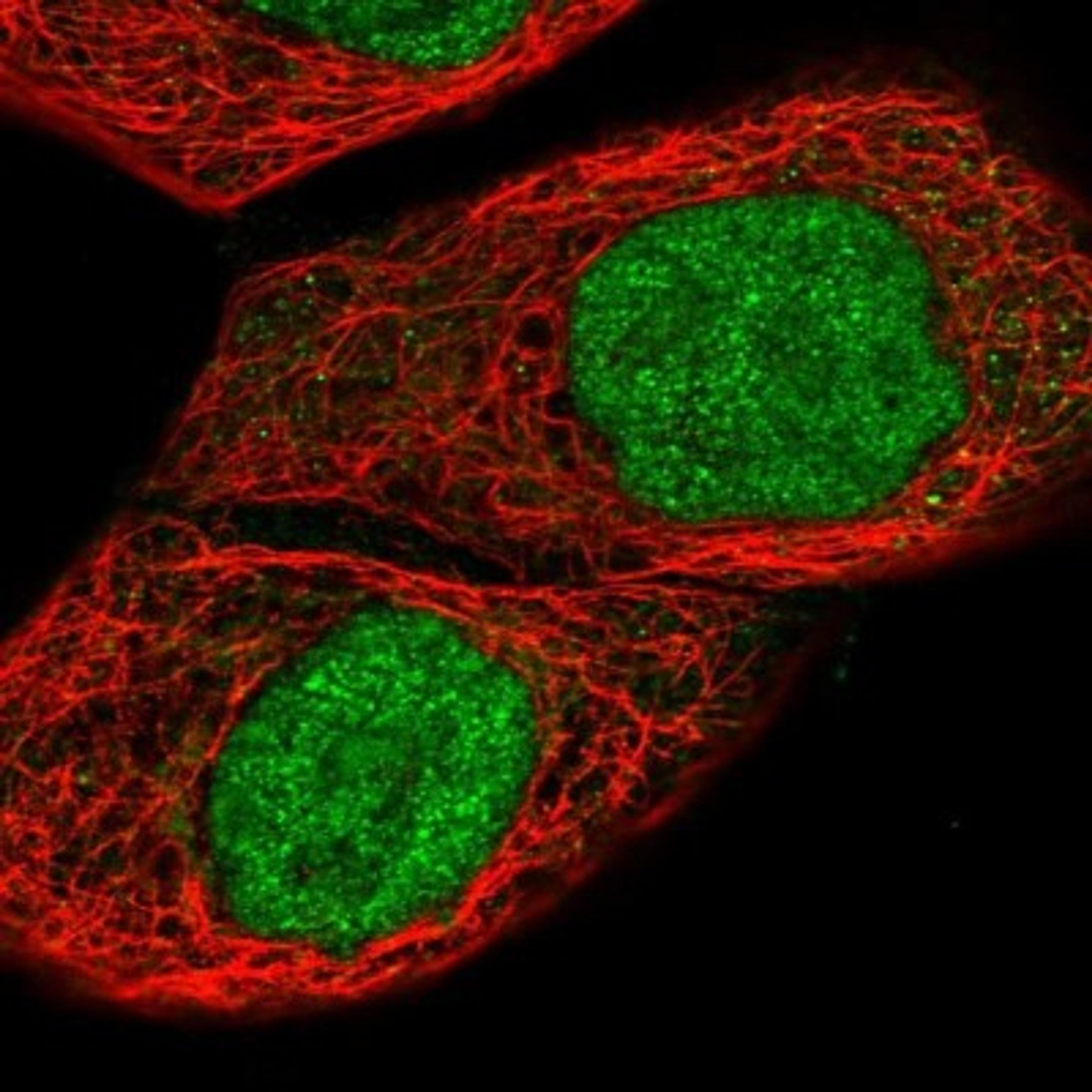 Immunocytochemistry/Immunofluorescence: DDX43 Antibody [NBP1-85419] - Staining of human cell line A-431 shows positivity in nucleus but not nucleoli.