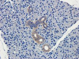 Immunohistochemical staining of mouse lymph node tissue using CD19 antibody (dilution of primary antibody - 1:100)