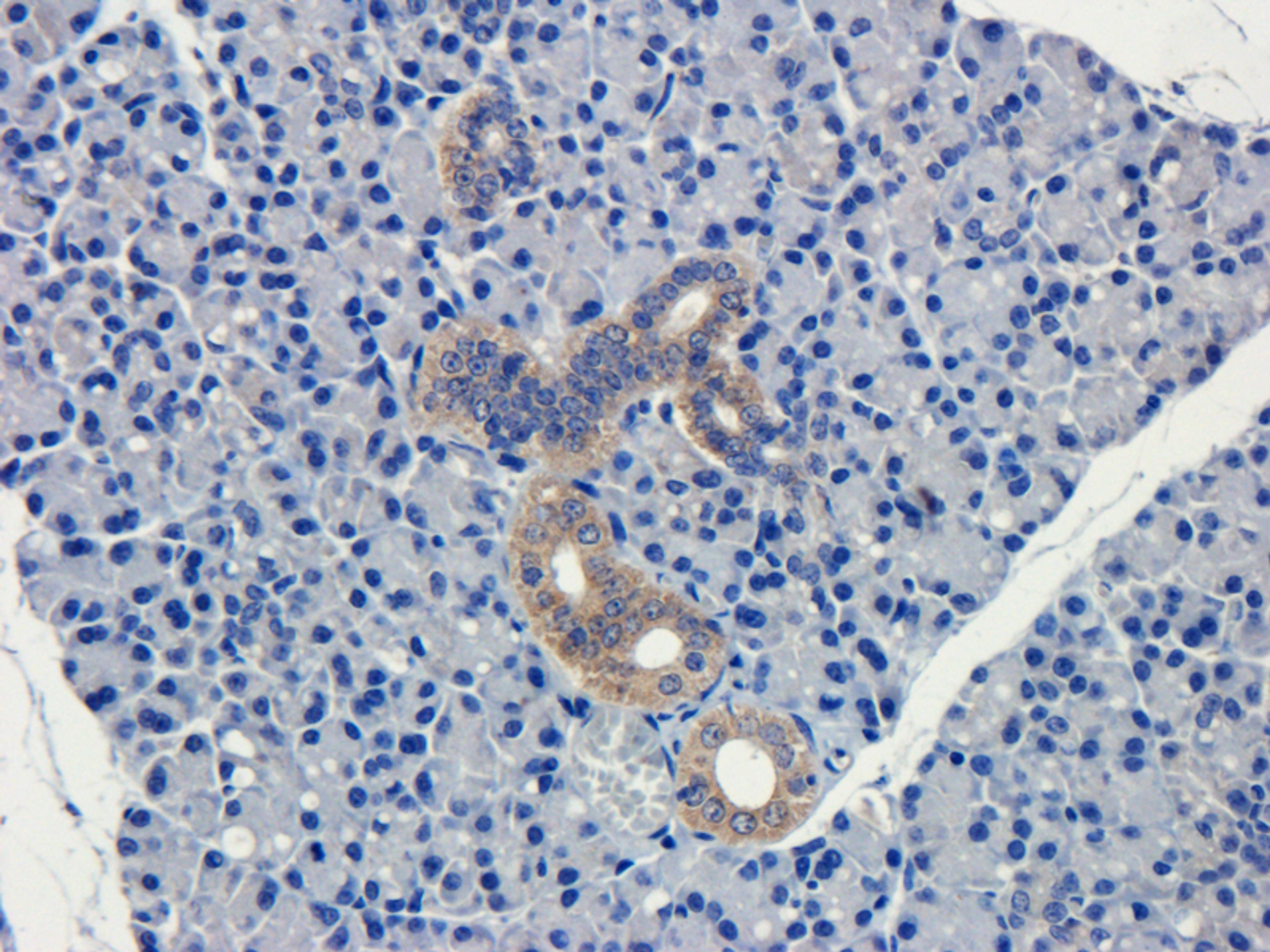 Immunohistochemical staining of mouse lymph node tissue using CD19 antibody (dilution of primary antibody - 1:100)