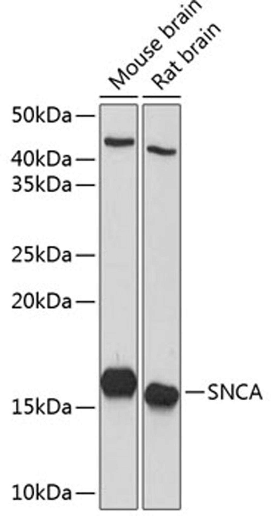 Western blot - SNCA Polyclonal Antibody (A13354)