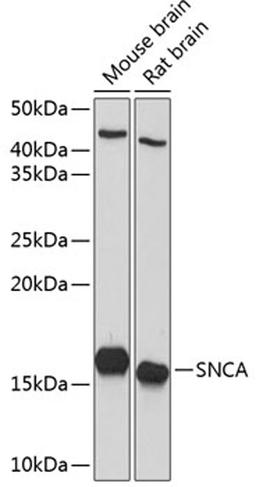 Western blot - SNCA Polyclonal Antibody (A13354)