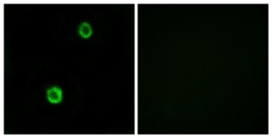 Immunocytochemistry/Immunofluorescence: Cystatin SN Antibody [NBP1-55995] - Analysis of MCF7 cells, using Cystatin SN Antibody. The picture on the right is treated with the synthesized peptide.