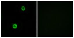 Immunocytochemistry/Immunofluorescence: Cystatin SN Antibody [NBP1-55995] - Analysis of MCF7 cells, using Cystatin SN Antibody. The picture on the right is treated with the synthesized peptide.