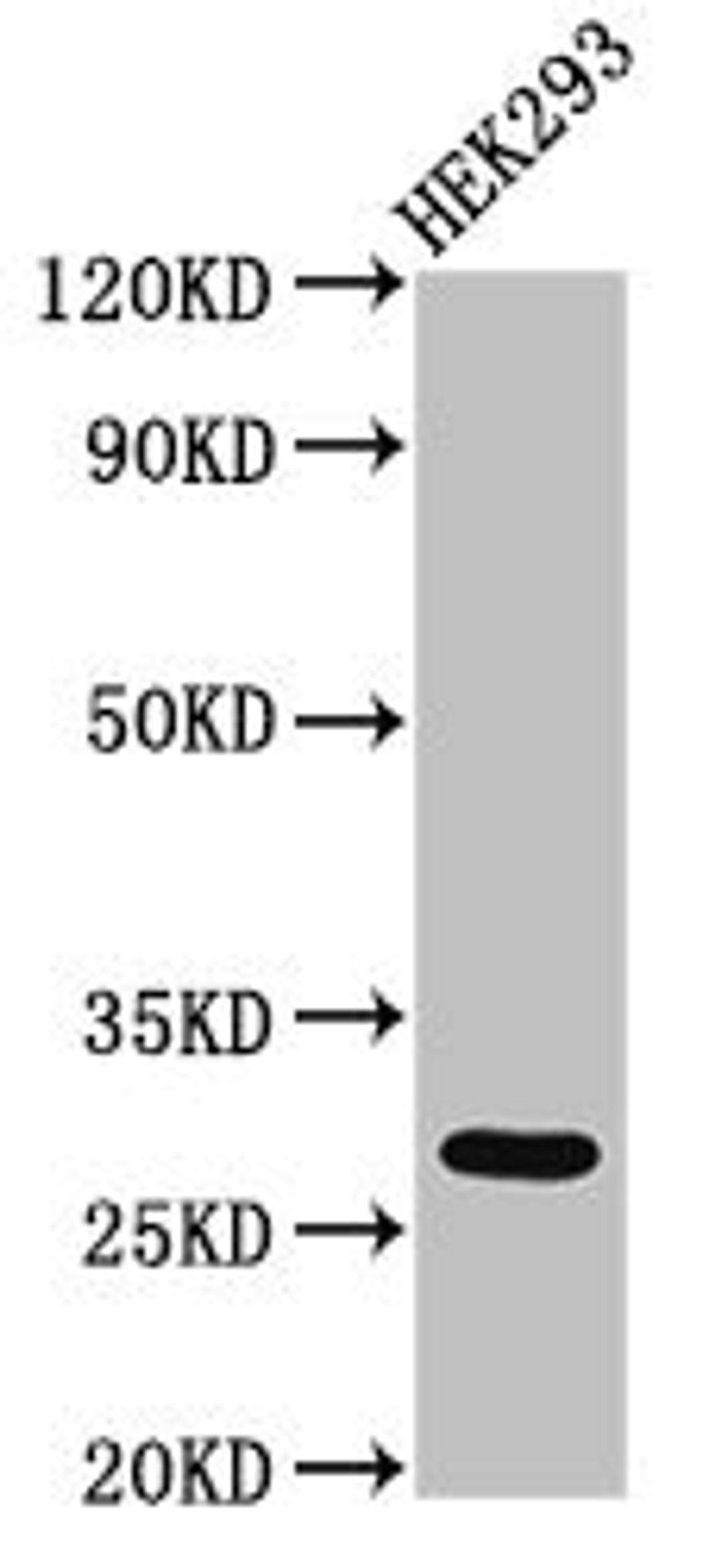 Western Blot. Positive WB detected in: HEK293 whole cell lysate. All lanes: ANKRD49 antibody at 3µg/ml. Secondary. Goat polyclonal to rabbit IgG at 1/50000 dilution. Predicted band size: 28 kDa. Observed band size: 28 kDa