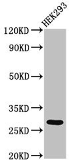 Western Blot. Positive WB detected in: HEK293 whole cell lysate. All lanes: ANKRD49 antibody at 3µg/ml. Secondary. Goat polyclonal to rabbit IgG at 1/50000 dilution. Predicted band size: 28 kDa. Observed band size: 28 kDa
