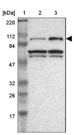 Western Blot: Gemin 3 Antibody [NBP1-84058] - Lane 1: Marker [kDa] 220, 112, 84, 47, 32, 26, 17<br/>Lane 2: Human cell line RT-4<br/>Lane 3: Human cell line U-251MG sp