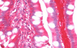 Immunohistochemical staining of human small intestine using TDO2 antibody