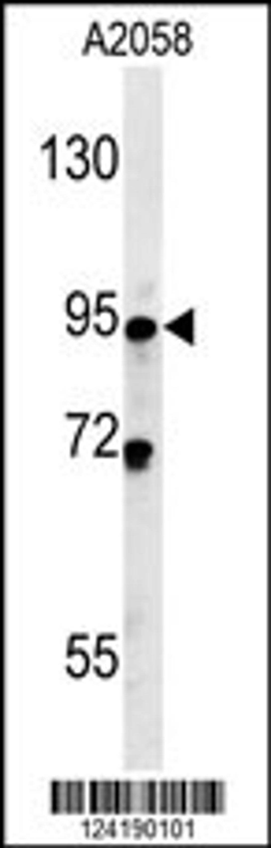 Western blot analysis in A2058 cell line lysates (35ug/lane).